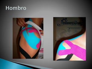 Exposicion vendaje neuromuscular