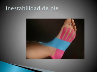 Exposicion vendaje neuromuscular