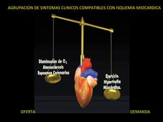 AGRUPACION DE SINTOMAS CLINICOS COMPATIBLES CON ISQUEMIA MIOCARDICA




     OFERTA                                          DEMANDA
 