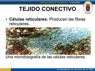 TEJIDO CONECTIVO
• Células reticulares: Producen las fibras
  reticulares.




Una microfotografía de las células reticulares
 