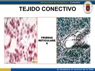 TEJIDO CONECTIVO



      FRIBRAS
     RETICULARE
          S
 