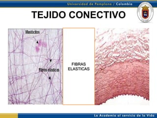 TEJIDO CONECTIVO
• DSCDD



             FIBRAS
           ELASTICAS
 