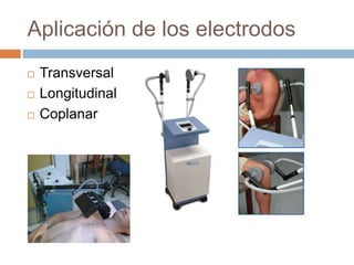 Aplicación de los electrodos
 Transversal
 Longitudinal
 Coplanar
 