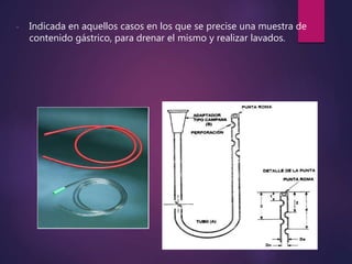 - Indicada en aquellos casos en los que se precise una muestra de
contenido gástrico, para drenar el mismo y realizar lavados.
 