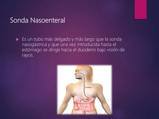Sonda Nasoenteral
 Es un tubo más delgado y más largo que la sonda
nasogástrica y que una vez introducida hasta el
estómago se dirige hacia el duodeno bajo visión de
rayos.
 