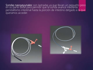 Sondas nasoyeyunales: son lastradas ya que llevan un pequeño peso
en su parte distal para permitir que la sonda avance mediante
peristaltismo intestinal hasta la porción de intestino delgado a la que
queramos acceder.
 