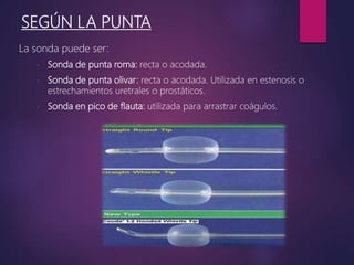 SEGÚN LA PUNTA
La sonda puede ser:
- Sonda de punta roma: recta o acodada.
- Sonda de punta olivar: recta o acodada. Utilizada en estenosis o
estrechamientos uretrales o prostáticos.
- Sonda en pico de flauta: utilizada para arrastrar coágulos.
 