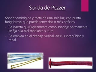 Sonda de Pezzer
Sonda semirrígida y recta de una sola luz, con punta
fungiforme, que puede tener dos o más orificios.
- Se inserta quirúrgicamente como sondaje permanente
se fija a la piel mediante sutura.
- Se emplea en el drenaje vesical, en el suprapúbico y
renal.
 