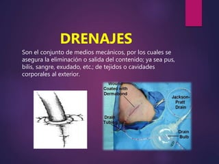 DRENAJES
Son el conjunto de medios mecánicos, por los cuales se
asegura la eliminación o salida del contenido; ya sea pus,
bilis, sangre, exudado, etc.; de tejidos o cavidades
corporales al exterior.
 
