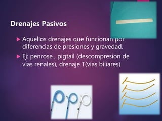 Drenajes Pasivos
 Aquellos drenajes que funcionan por
diferencias de presiones y gravedad.
 Ej: penrose , pigtail (descompresion de
vías renales), drenaje T(vías biliares)
 