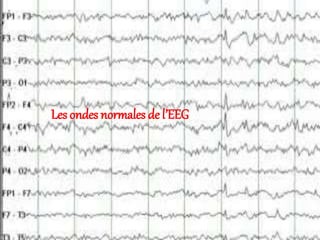 Les ondes normales de l’EEG
 