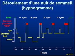 Exposé sur le sommeil et EEG