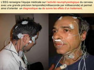 L’EEG renseigne l’équipe médicale sur l’activité neurophysiologique du cerveau
avec une grande précision temporelle(milliseconde par milliseconde) et permet
ainsi d’orienter un diagnostique ou de suivre les effets d’un traitement.
 