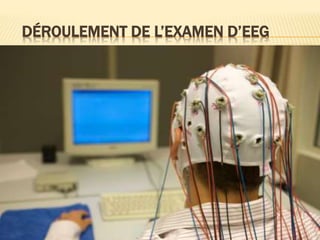 DÉROULEMENT DE L’EXAMEN D’EEG
 