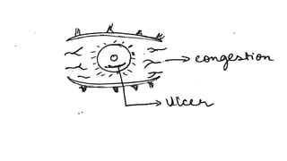 EXPOSURE KERATITIS.PPT ophthalmology post graduate | PPTX