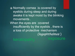 exposurekeratopathy.pptx