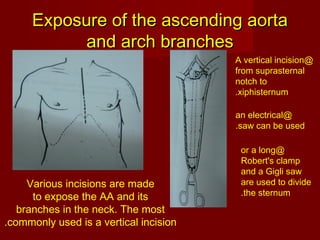 Exposure of major blood vessels | PPT