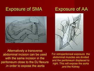 Exposure of major blood vessels | PPT