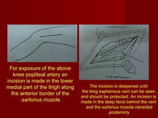 Exposure of major blood vessels | PPT