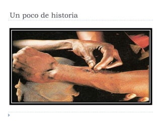 Un poco de historia
 