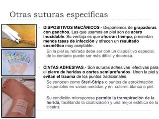 Otras suturas específicas
• DISPOSITIVOS MECÁNICOS.- Disponemos de grapadoras
con ganchos. Las que usamos en piel son de acero
inoxidable. Su ventaja es que ahorran tiempo, presentan
menos tasas de infección y ofrecen un resultado
cosmético muy aceptable.
En la piel su retirada debe ser con un dispositivo especial,
de lo contario puede ser más difícil y dolorosa.
• CINTAS ADHESIVAS.- Son suturas adhesivas efectivas para
el cierre de heridas o cortes semiprofundos. Unen la piel y
evitan el trauma de los puntos tradicionales.
Se conocen como Steri-Strips o puntos de aproximación.
Disponibles en varias medidas y en colores blanco o piel.
Su condición microporosa permite la transpiración de la
herida, facilitando la cicatrización y una mejor estética de la
cicatriz.
 