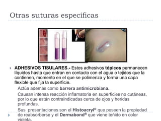 Otras suturas específicas
 ADHESIVOS TISULARES.- Estos adhesivos tópicos permanecen
líquidos hasta que entran en contacto con el agua o tejidos que la
contienen, momento en el que se polimeriza y forma una capa
flexible que fija la superficie.
Actúa además como barrera antimicrobiana.
Causan intensa reacción inflamatoria en superficies no cutáneas,
por lo que están contraindicadas cerca de ojos y heridas
profundas.
Sus presentaciones son el HistoacrylR que poseen la propiedad
de reabsorberse y el DermabondR que viene teñido en color
 
