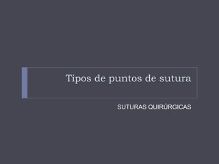 Tipos de puntos de sutura
SUTURAS QUIRÚRGICAS
 