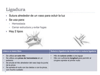 Ligadura
 Sutura alrededor de un vaso para ocluir la luz
 Se usa para:
 Hemostasia
 Cerrar estructura y evitar fugas
 Hay 2 tipos:
Libre o a mano libre Sutura o ligadura de transfixión o sutura ligadura
• Se utiliza un solo hilo
• Se utiliza una pinza de hemostasia en un
extremo
• Se anuda el hilo alrededor del vaso bajo la punta
de la pinza
• Se aprieta el nudo con los dedos o con la pinza,
con mucho cuidado
• Hilo de sutura unido a una aguja
• Hilo con suficiente longitud para permitir al
cirujano apretar el primer nudo
 