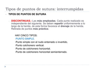 Tipos de puntos de sutura: interrumpidas
• TIPOS DE PUNTOS DE SUTURA
– DISCONTINUAS.- Las más empleadas. Cada punto realizado es
independiente del siguiente. Se deben repartir uniformemente a lo
largo de la herida, de esta forma favorece el drenaje de la herida.
Retirada de puntos más práctico.
HAY CINCO TIPOS:
•PUNTO SIMPLE.
•Punto simple con el nudo enterrado o invertido.
•Punto colchonero vertical.
•Punto de colchonero horizontal.
•Punto de colchonero horizontal semienterrado.
 