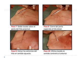 Paso 7: Doble lazada sobre el
porta del hilo proximal.
Paso 8: Cierre del porta
cogiendo el hilo distal.
Paso 9: Estirar los extremos del
hilo en sentido opuesto.
Paso 10: Última lazada en
sentido contrario al anterior.
 