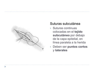  Suturas subcutánea
 Suturas continuas
colocadas en el tejido
subcutáneo por debajo
de la capa epitelial, en
línea paralela a la herida
 Deben ser puntos cortos
y laterales
 