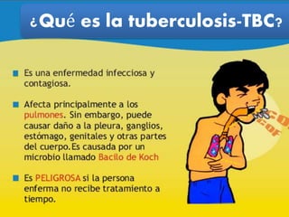 ¿Qué es la tuberculosis-TBC?
 