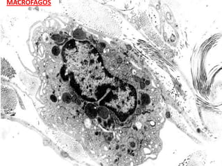 MACRÓFAGOS
 