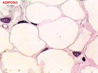 ADIPOSO
 