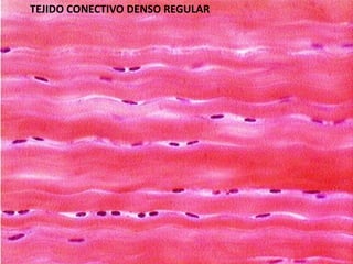 TEJIDO CONECTIVO DENSO REGULAR
 