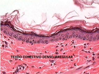 TEJIDO CONECTIVO DENSO IRREGULAR
 