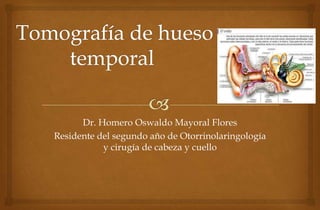 Dr. Homero Oswaldo Mayoral Flores
Residente del segundo año de Otorrinolaringología
y cirugía de cabeza y cuello
 