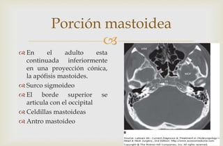 
Porción mastoidea
 En el adulto esta
continuada inferiormente
en una proyección cónica,
la apófisis mastoides.
 Surco sigmoideo
 El borde superior se
articula con el occipital
 Celdillas mastoideas
 Antro mastoideo
 