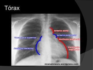 Torax Simple ANatomia Basica de Torax | PPTX