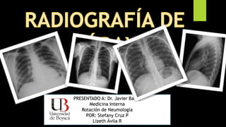 PRESENTADO A: Dr. Javier Barón
Medicina Interna
Rotación de Neumología
POR: Stefany Cruz P
Lizeth Ávila R
 