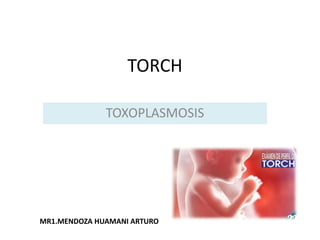 TORCH
TOXOPLASMOSIS
MR1.MENDOZA HUAMANI ARTURO
 