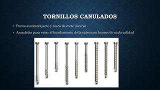 TORNILLOS CANULADOS
• Punta autotarrajante y rosca de corte inverso
• Arandelas para eviar el hundimineto de la cabeza en huesos de mala calidad
 