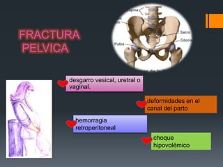 FRACTURA
PELVICA

      desgarro vesical, uretral o
      vaginal.

                                    deformidades en el
                                    canal del parto
        hemorragia
        retroperitoneal
                                      choque
                                      hipovolémico
 