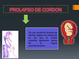 PROLAPSO DE CORDON




      Es una condición durante las
      últimas etapas de embarazo
      en las que el cordón
      umbilical desciende dentro
      de         la        vagina
      prematuramente.
 