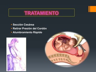 TRATAMIENTO

 Sección Cesárea
 Retirar Presión del Cordón
 Alumbramiento Rápido
 