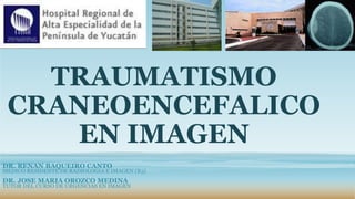 TRAUMATISMO
CRANEOENCEFALICO
EN IMAGEN
DR. RENAN BAQUEIRO CANTO
MEDICO RESIDENTE DE RADIOLOGIA E IMAGEN (R3)
DR. JOSE MARIA OROZCO MEDINA
TUTOR DEL CURSO DE URGENCIAS EN IMAGEN
 