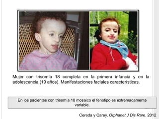 Mujer con trisomía 18 completa en la primera infancia y en la 
adolescencia (19 años). Manifestaciones faciales características. 
En los pacientes con trisomía 18 mosaico el fenotipo es extremadamente 
variable. 
Cereda y Carey, Orphanet J Dis Rare. 2012 
 