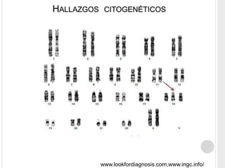 HALLAZGOS CITOGENÉTICOS 
www.lookfordiagnosis.com,www.ingc.info/ 
 
