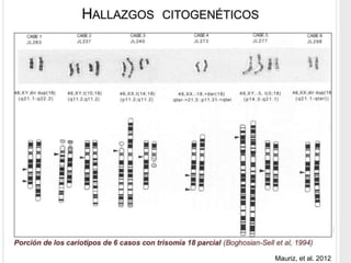 HALLAZGOS CITOGENÉTICOS 
Mauriz, et al. 2012 
 