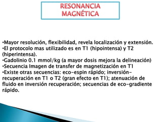 •Mayor resolución, flexibilidad, revela localización y extensión.
•El protocolo mas utilizado es en T1 (hipointensa) y T2
(hiperintensa).
•Gadolinio 0.1 mmol/kg (a mayor dosis mejora la delineación)
•Secuencia Imagen de transfer de magnetización en T1
•Existe otras secuencias: eco-espin rápido; inversión-
recuperación en T1 o T2 (gran efecto en T1); atenuación de
fluido en inversión recuperación; secuencias de eco-gradiente
rápido.
 